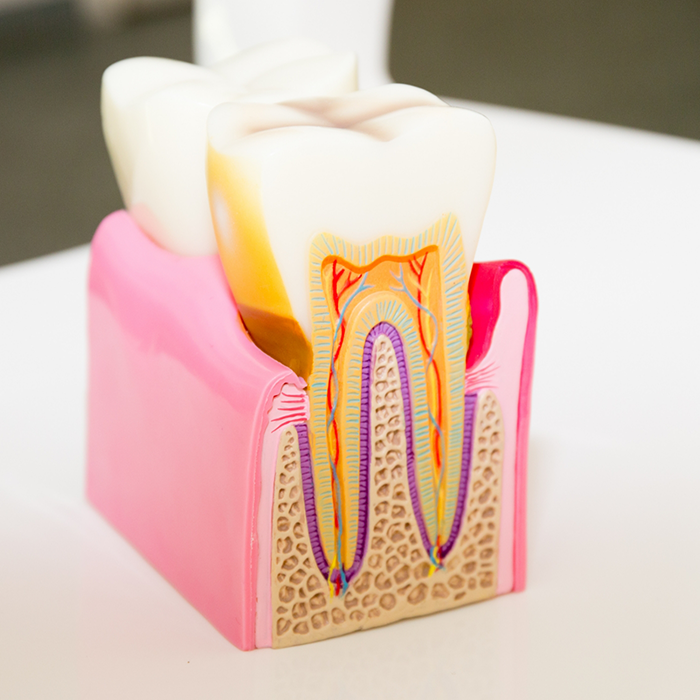 Model of a tooth showing the layers inside of it