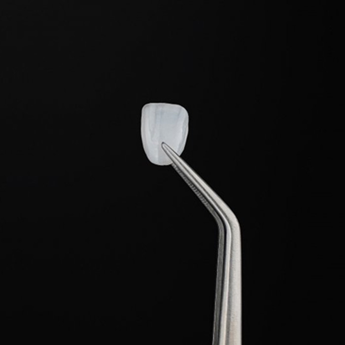 Veneers held with tweezers
