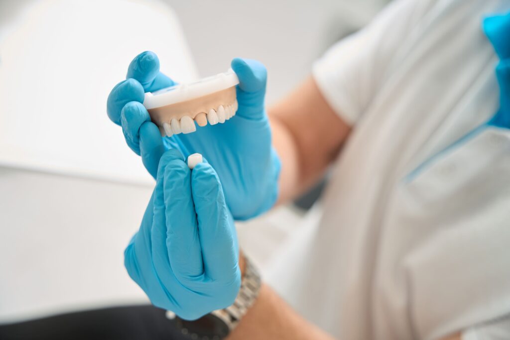 Dentist placing sample crown over model tooth